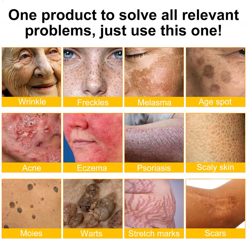 ✨✨Tiworld™ Bee venom Comprehensive Cream — 🔥Limited Time 80% OFF🔥