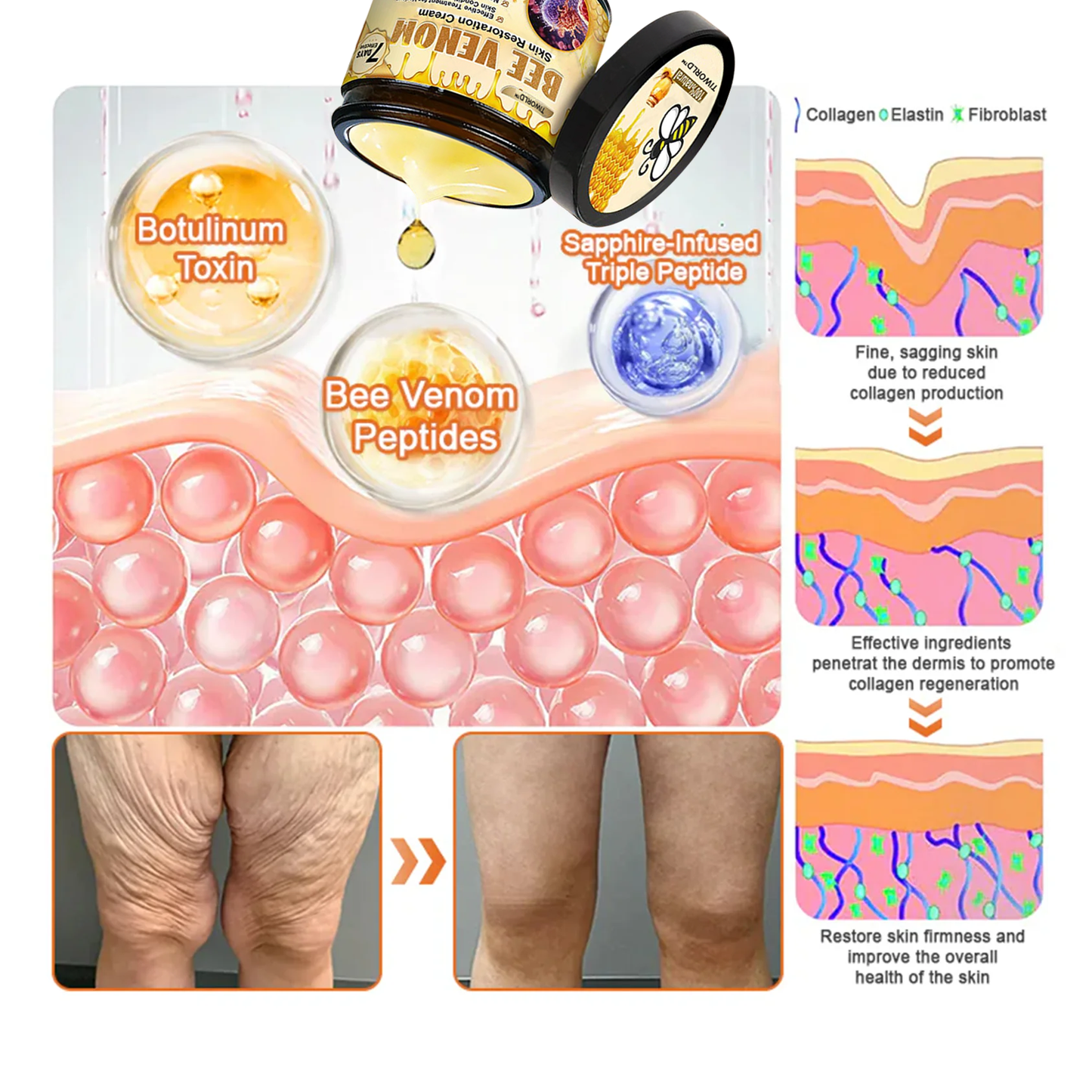 ✨✨Tiworld™ Bee venom Comprehensive Cream — 🔥Limited Time 80% OFF🔥