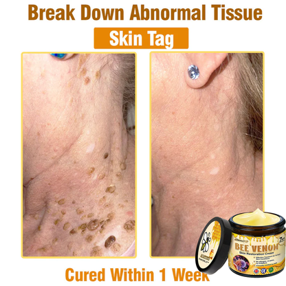✨✨Tiworld™ Bee venom Comprehensive Cream — 🔥Limited Time 80% OFF🔥